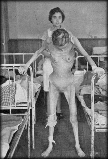 Margit Swartz, helpless and with her mind unhinged, climbed out of the bed unaided when she saw the camera